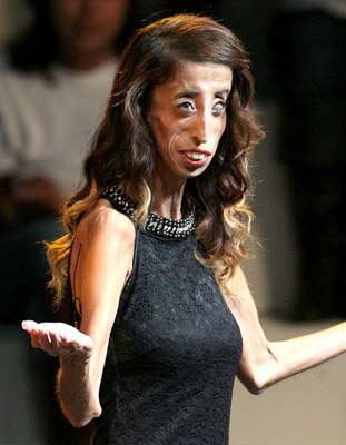 Lizzie Velásquez