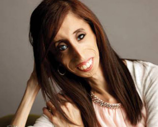 Lizzie Velásquez